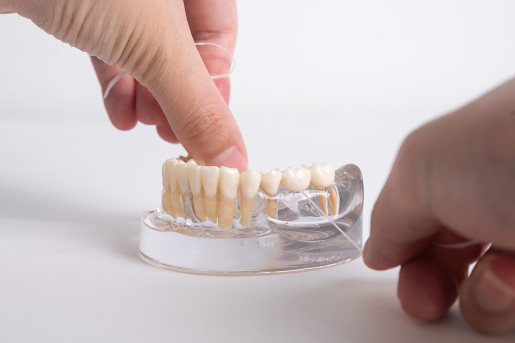 Dental Bridges Las Vegas